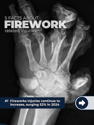 🚨 Firework Safety Alert! 🚨 

After several incidents over July 4th, including a serious injury to a 14-year-old in Prince George's County, the State Fire Marshal warns against illegal fireworks. An unauthorized show in Harford County led to the confiscation of over 1,300