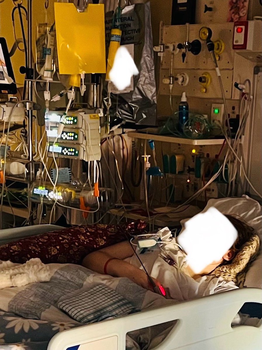 Erin M (@erinapn1) on Twitter photo <a href="/toadmeister/">Toby Young</a> My now 17 year old. Can’t eat or drink (has no peristalsis from oesophagus to end of large bowel), neurogenic bladder, 3x stomas to try to feed her and eliminate waste (but her gut doesn’t want to absorb so often she has iv nutrition into her heart), a central line into her heart <a href="/toadmeister/">Toby Young</a> My now 17 year old. Can’t eat or drink (has no peristalsis from oesophagus to end of large bowel), neurogenic bladder, 3x stomas to try to feed her and eliminate waste (but her gut doesn’t want to absorb so often she has iv nutrition into her heart), a central line into her heart