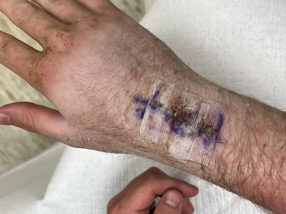 Logan Moore (@loganmoore282) on Twitter photo Doctor cleared me today for cardio activity! So I got right to it! Waiting on an MRI for my left hand, but Praying it’s not broke so I can get back out there!
{GODS PLAN} <a href="/BennettSwygert/">Bennett Swygert</a> <a href="/train0187/">TRAINBUILT PERFORMANCE</a> <a href="/CoachCotney/">Clay Cotney</a> <a href="/padgett_johnson/">Padgett Johnson</a> <a href="/Ram_Footb_Media/">Hillcrest_Football_Media</a> <a href="/HighSchoolBlitz/">High School Blitz</a> Doctor cleared me today for cardio activity! So I got right to it! Waiting on an MRI for my left hand, but Praying it’s not broke so I can get back out there!
{GODS PLAN} <a href="/BennettSwygert/">Bennett Swygert</a> <a href="/train0187/">TRAINBUILT PERFORMANCE</a> <a href="/CoachCotney/">Clay Cotney</a> <a href="/padgett_johnson/">Padgett Johnson</a> <a href="/Ram_Footb_Media/">Hillcrest_Football_Media</a> <a href="/HighSchoolBlitz/">High School Blitz</a>