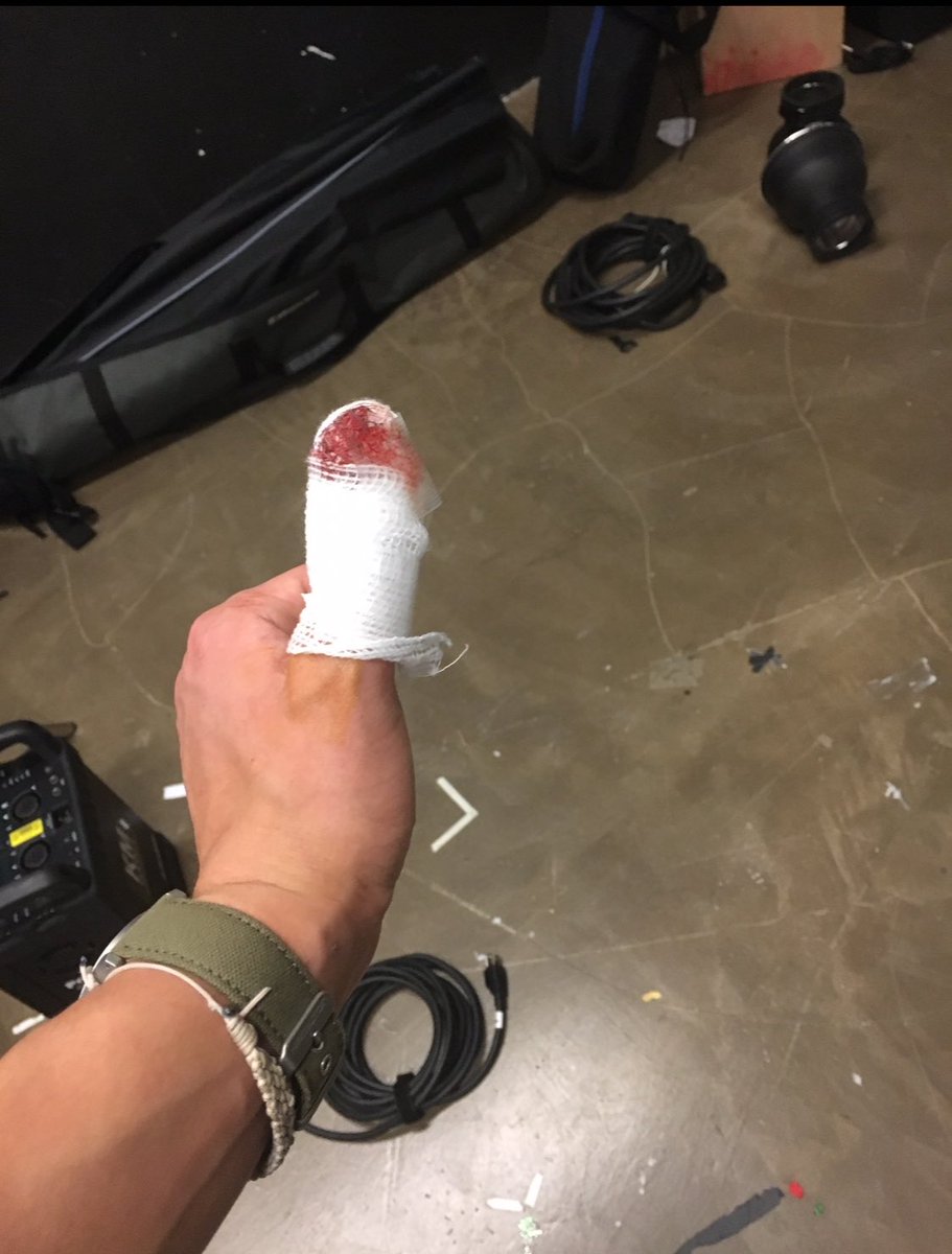 had to wake up at 3 am for this shoot because i had to stop at the hospital on the way there because id shot a crossbow into my thumb the night before by mistake
