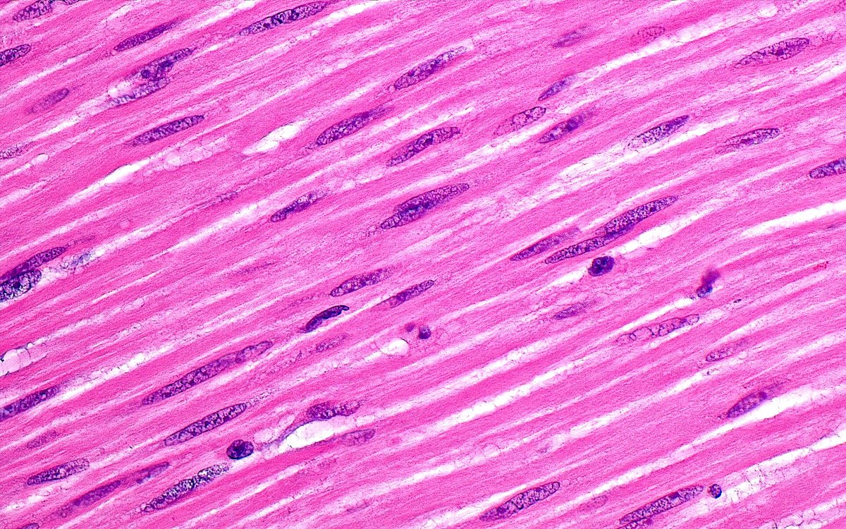 ziad_zaatari's tweet image. 🔬 Smooth Muscle Cells ~ #Histology #Pathology #PathArt 📸🎨