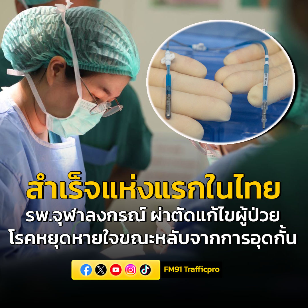 fm91trafficpro's tweet photo. ปรบมือ! ทีมแพทย์ รพ.จุฬาลงกรณ์ นำเทคนิคใหม่ ผ่าตัดแก้ไขผู้ป่วย โรคหยุดหายใจขณะหลับจากการอุดกั้น (OSA) สำเร็จ แห่งแรกในประเทศไทย 
อ่านต่อคลิก >>>  https://t.co/5BABAtPilQ 
#FM91 #หยุดหายใจขณะหลับ #จุฬาลงกรณ์ https://t.co/RALOvQCz89