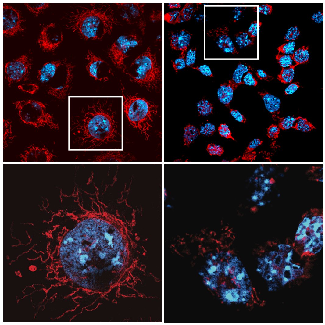 WEHI_research's tweet image. New research: MCL-1 not only prevents cell death, also fuels cells by supporting energy production. Helps explain side effects seen with MCL-1 targeting drugs in cancer clinical trials; could lead to better therapies. In @ScienceMagazine
🔗wehi.edu.au/news/hidden-ro…