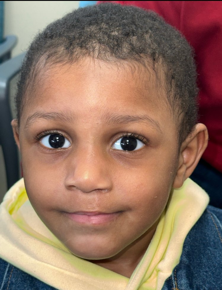 ColumbiaSurgery's tweet image. Cleft lip and palate affect 1 in 700 births, and behind every case is a story of strength, resilience, and endless cuteness. Meet Saeed, our smile of the month!
"One of my goals is to really highlight the incredible journeys our patients have gone through. I’m really proud of…