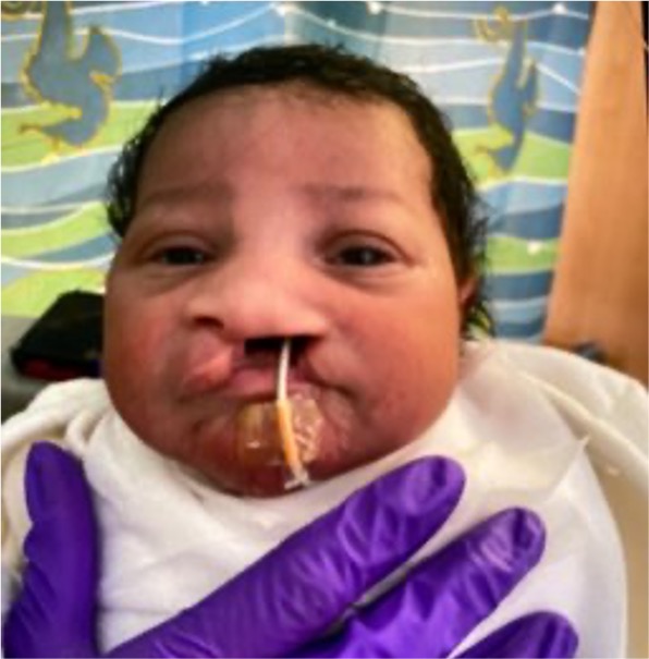 ColumbiaSurgery's tweet image. Cleft lip and palate affect 1 in 700 births, and behind every case is a story of strength, resilience, and endless cuteness. Meet Saeed, our smile of the month!
"One of my goals is to really highlight the incredible journeys our patients have gone through. I’m really proud of…