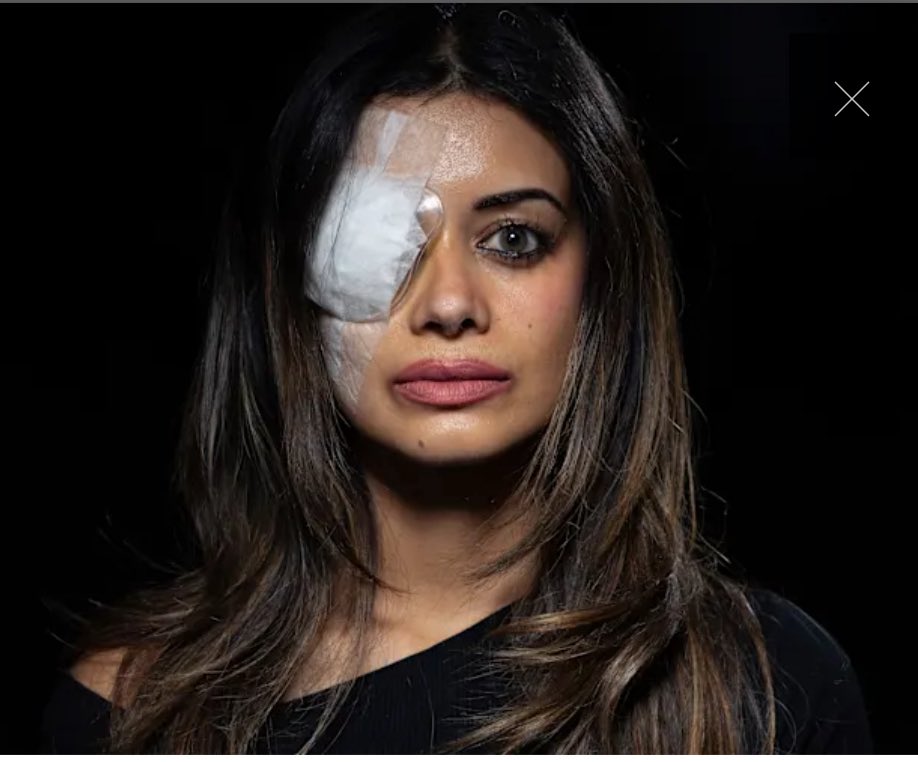 State violence eclipses any acts by genuine protesters

The Duopolies support for genocide is violence

The repressive laws to "protect" 0.46% of the population are violent