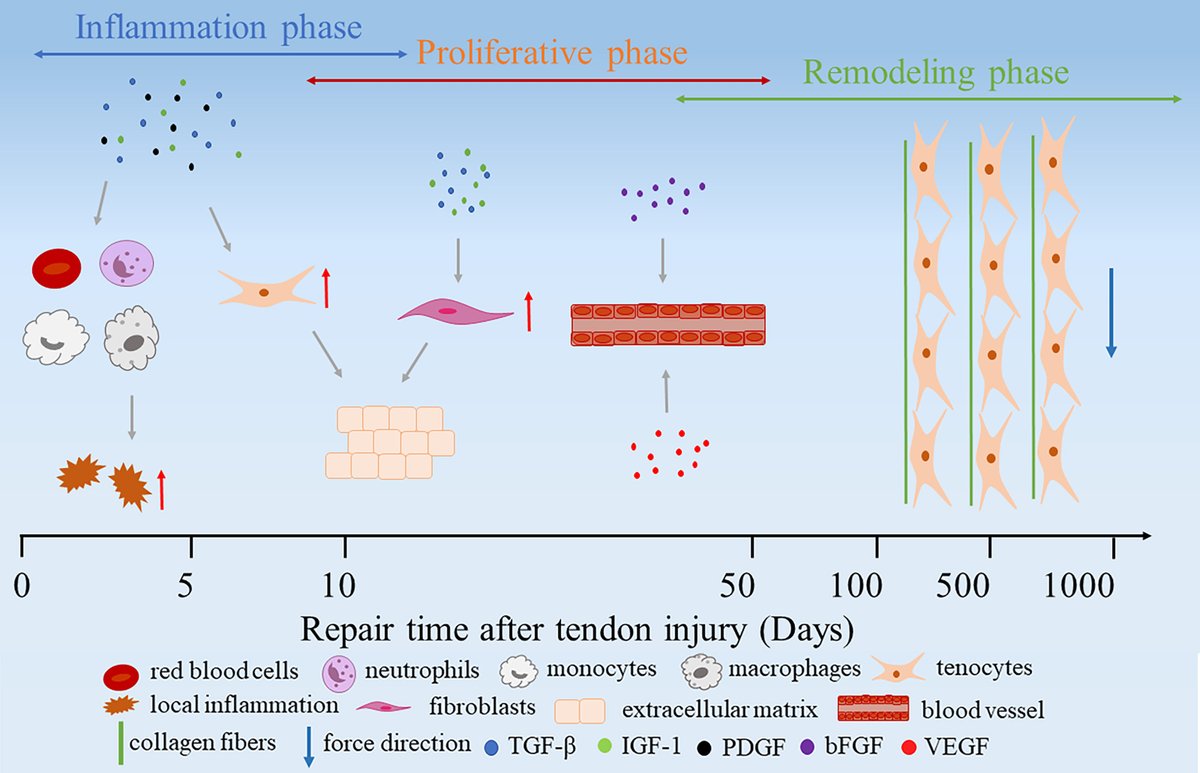 Landmark_IMR's tweet image. #Biotechnology Series--1
🆕 Explore the latest research across biomedicine:
🔹 Graphene-Mn₃O₄ nanoparticles show promise for photodynamic cancer therapy
🔹 AI models outperform traditional methods in early COVID-19 triage
🔹 Oligosaccharide biomarkers enable tracking enzyme…