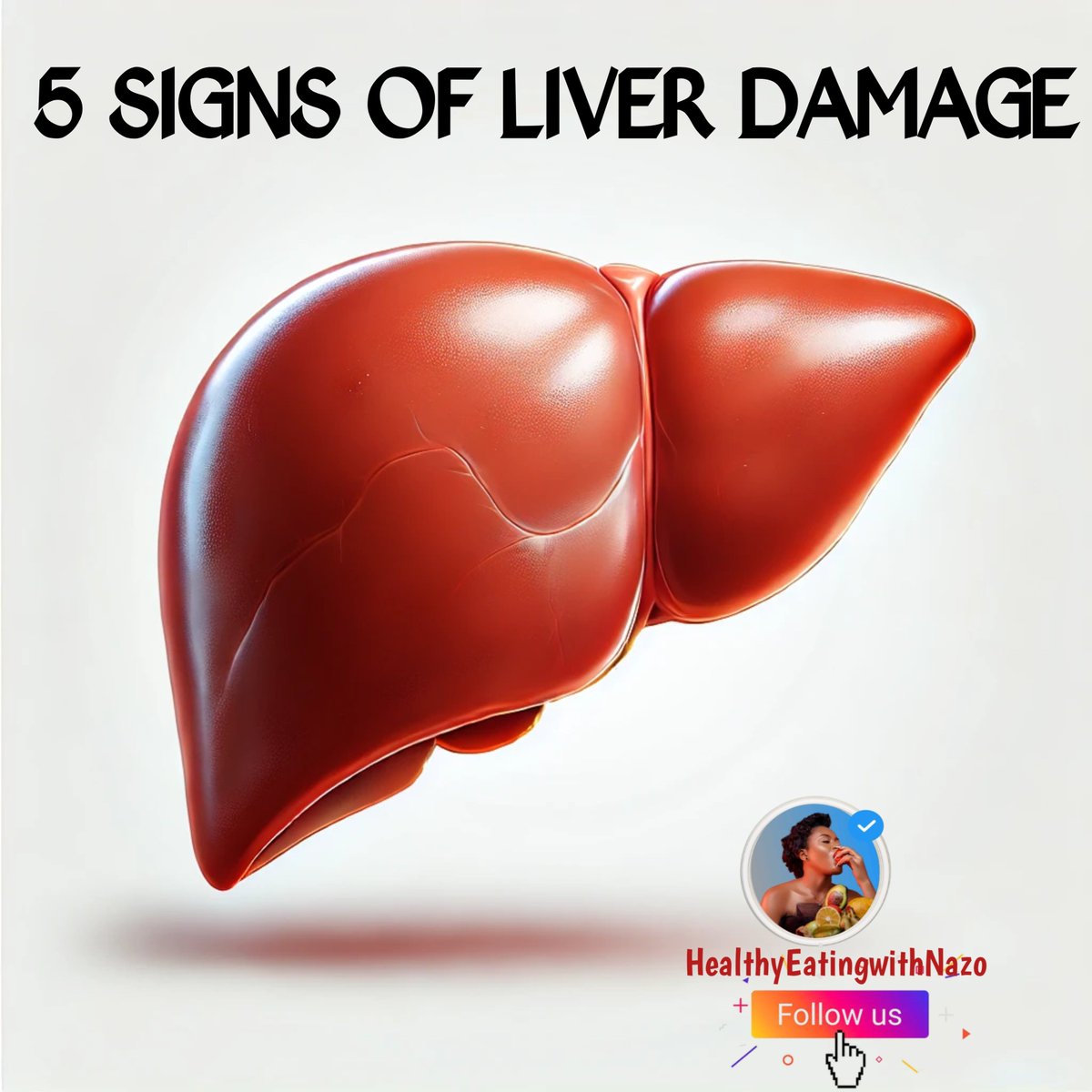 EATINGWITHNAZO's tweet image. FIVE WARNING SIGNS OF LIVER DAMAGE

A DETAILED THREAD 🧵