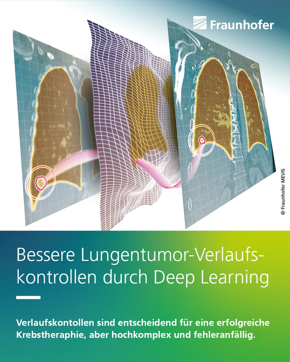 Fraunhofer's tweet image. CT-Aufnahmen sind essenziell für #Diagnostik und Kontrolle von Bronchialkarzinomen. Die #DeepLearning-Software #SPIRABENE vom Fraunhofer MEVIS erkennt 11 Prozent mehr Tumore in einem Zehntel der Zeit!
Mehr: s.fhg.de/WfUn
#Gesundheit #KI