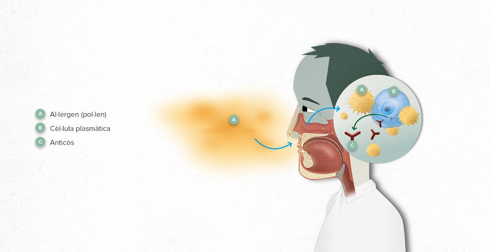 📅Hoy es el Día Mundial de la #alergia🤧.

Es una respuesta exagerada del sistema inmunitario🛡️ a sustancias llamadas alérgenos, como el polvo, alimentos, medicamentos, veneno de insectos o sustancias como el perfume o los metales🧴💍...

➕Info 👉 tinyurl.com/yc3j2wrd