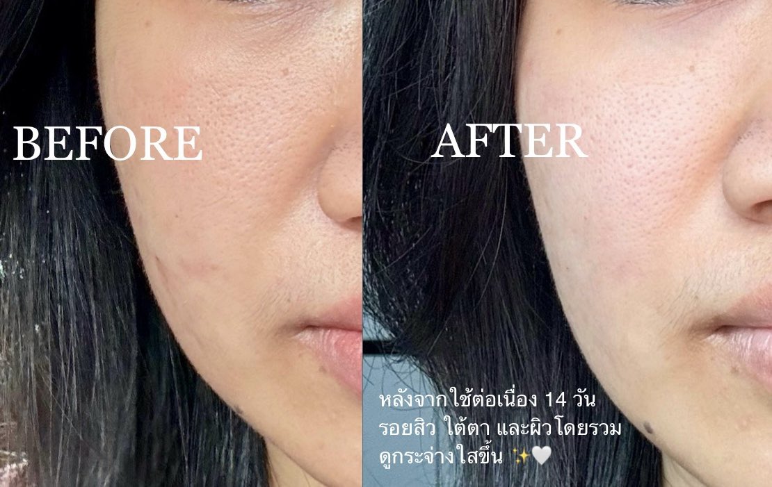 uptothemoonsp's tweet photo. ผิวหมองคล้ำ ใต้ตาดำ รอยสิวแก้ได้ด้วย BANOBAGI Sleeping mask สูตรคาเฟอีนตัวโปรด ✨ ทั้งอ่อนโยนและช่วยปลอบประโลมผิวได้ทันทีตั้งแต่ใช้ครั้งแรกเลย คนเป็นสิวผิวผสมใช้ได้ทุกวันแบบสบายใจแน่นอน 🫶🏻🤍☕️
#BANOBAGI #BanobagiLoveAtFirstFlight #DaouOffroadLoveAtFirstFlight #FlyingWithOUROAD https://t.co/OiVw0y3DTr