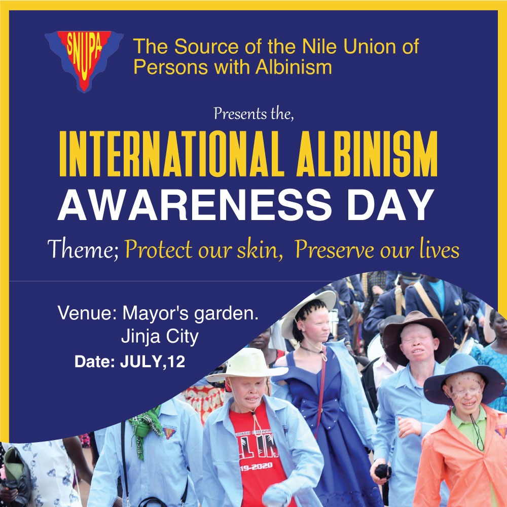The Jinja edition of the International Albinism Awareness Day is on this Saturday July 12 at the Mayor's Garden, Jinja city. Come all. 
#SNUPA