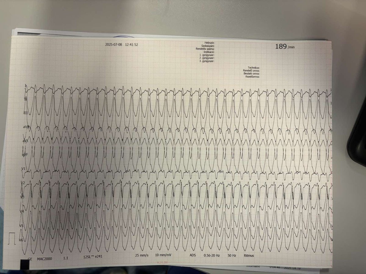 What type of VT is this, and where is it originating from?