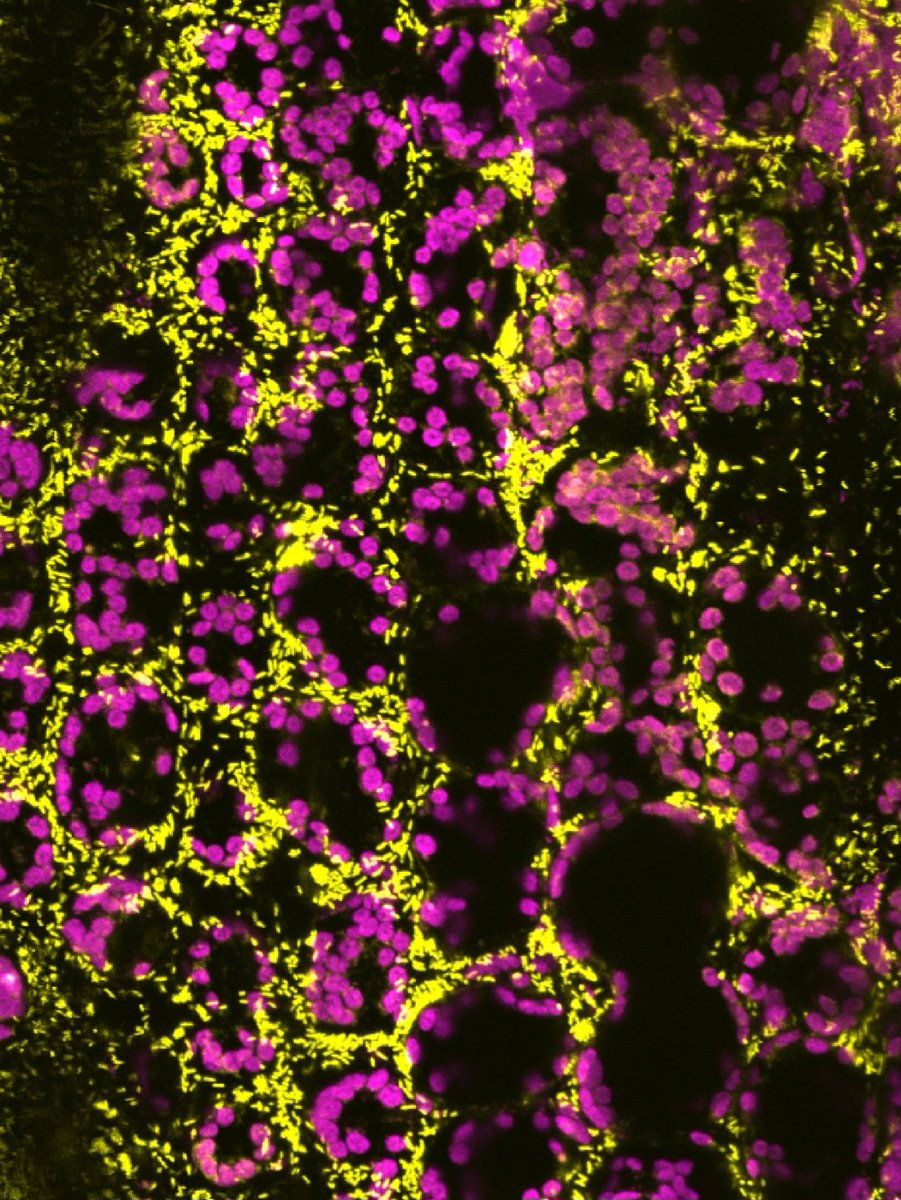 Excited to share our work on the functional replacement of T4SS by T6SS for bacterial killing in Xanthomonas

Read the full story: rdcu.be/euNrM

🎥 Real-time imaging shows T6SS in action

Grateful for great collaborations: <a href="/jmjacobs2/">jj</a> lab and <a href="/koebnik_ralf/">Ralf Koebnik</a>

<a href="/Bragard_C/">Bragard</a>