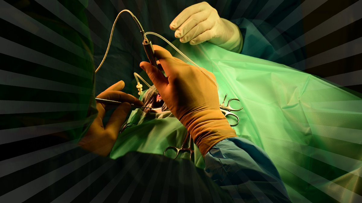 👁️ What is the glaucoma risk after pars plana vitrectomy (PPV)?

A new retrospective cohort study from the Byers Eye Institute analyzed over 42,000 PPV cases using data from TriNetX to quantify long-term glaucoma risk.

Read more: ow.ly/6iPC50W8Uv0

#OphthoTwitter