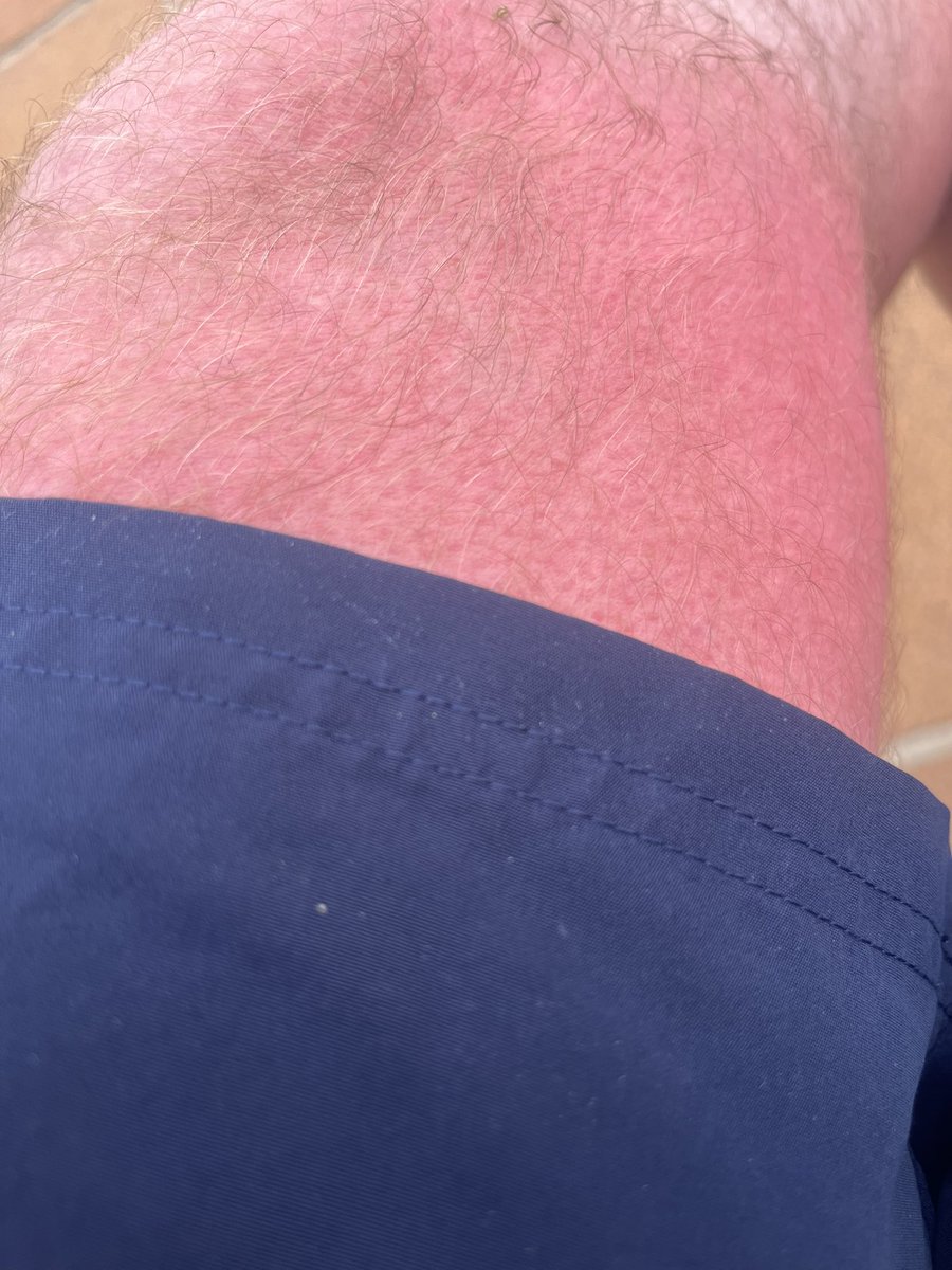 Ibiza away 

Red &amp; Blue 

Sun 1-0 Yorkie