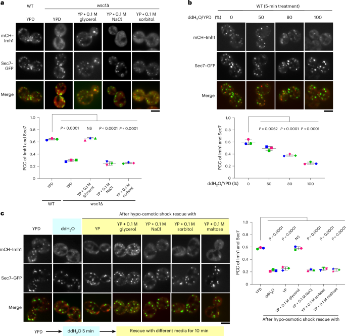 NatureSMB's tweet image. New online! Glycerol mediates crosstalk between metabolism and trafficking through the golgin Imh1 bit.ly/4ks4bAT