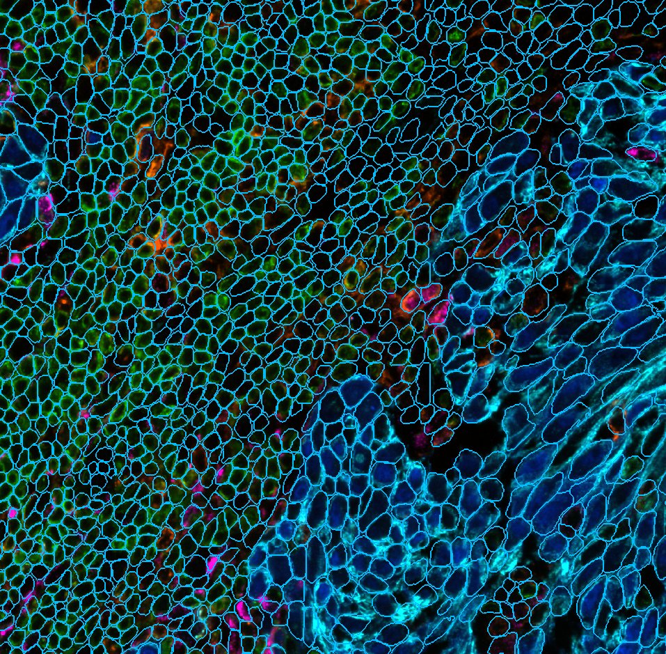 lunaphore's tweet image. Interested in elevating your #spatialbiology research to the next level?
Discover the intuitive marker-based cell segmentation on our HORIZON™ software that allows you to identify all your cells in just a few clicks.
Download our brochure now: link.lunaphore.com/3w1