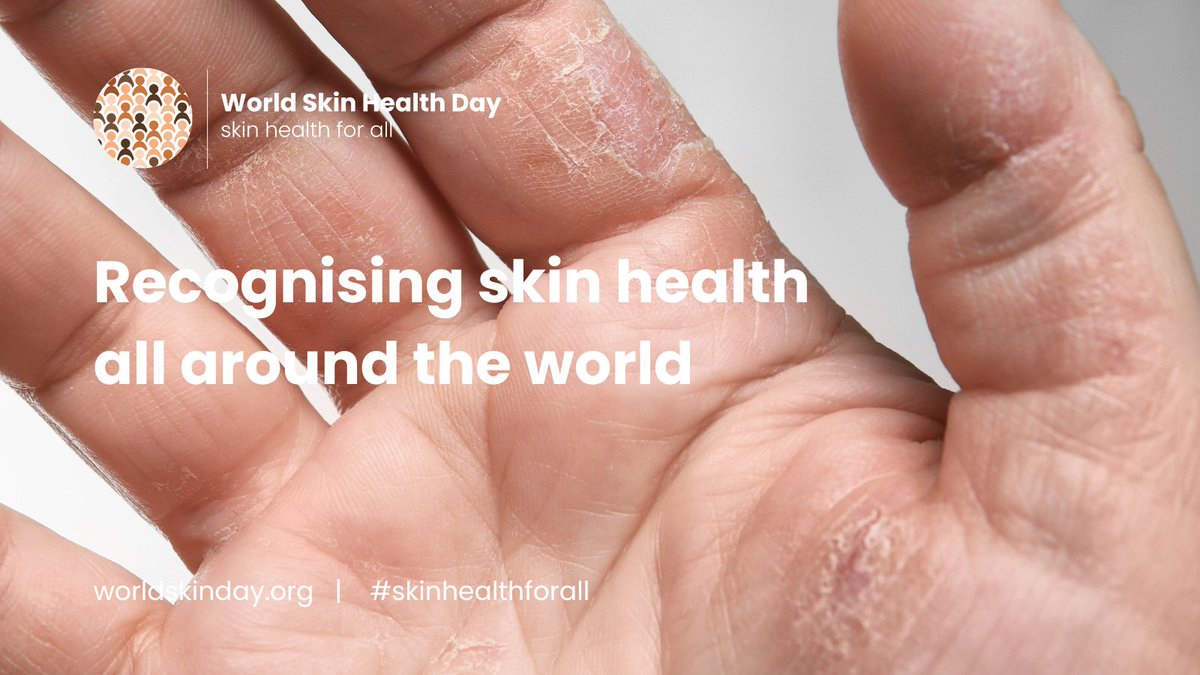 Psoriasis Association tweet media