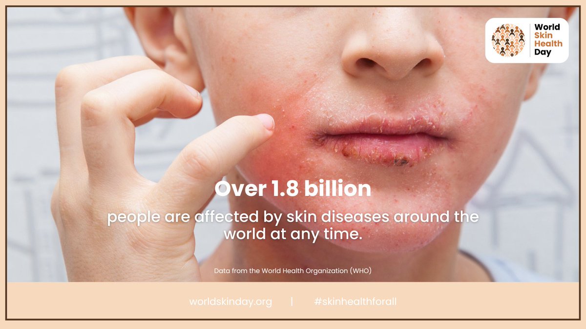 Psoriasis Association tweet media