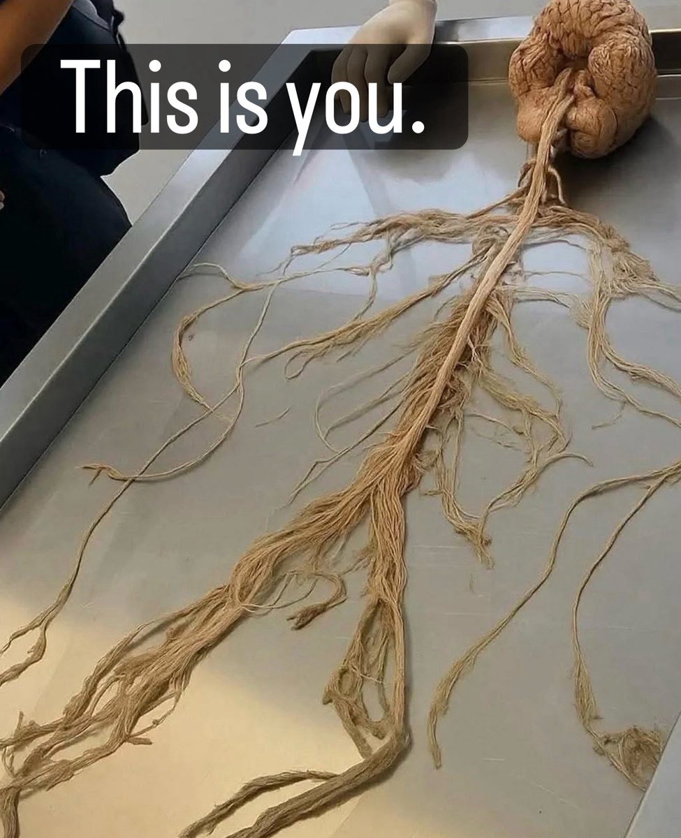 Once you realize your entire consciousness is just a tangled pile of electric ramen wrapped in a muscle suit of moving bones, you start to wonder why you ever cared so much about your friends not liking your story post. #anatomy #nervoussystem #medical #doctor #brain  photo