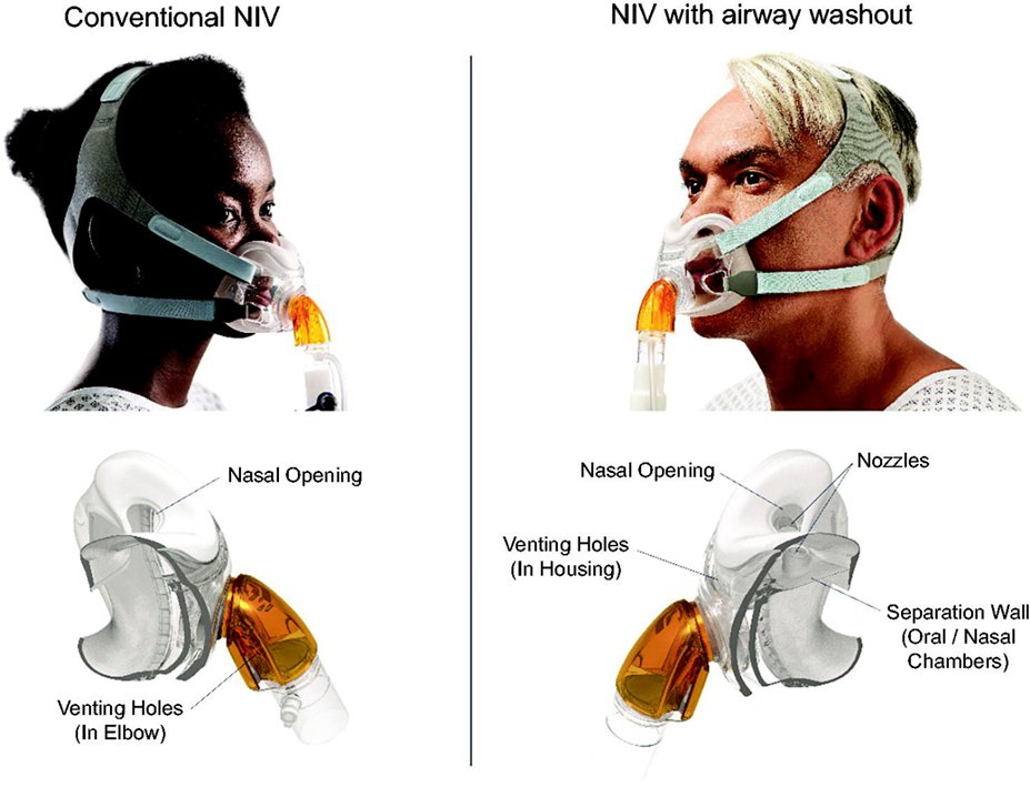 Clark et al used a computational fluid dynamics model to study mask design used for noninvasive ventilation (NIV) and the impact on upper airway washout of CO2.
Paper: liebertpub.com/doi/10.1089/re…
Editorial: liebertpub.com/doi/10.1089/re…