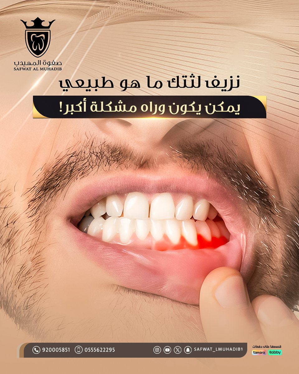 Safwat_lmuhadib's tweet image. لا تقول "عادي" نزيف اللثة ما هو شي طبيعي … افحص لثتك الآن وابدأ رحلة العناية بصحة فمك، في صفوة المهيدب، نهتم بلثتك مثل ما نهتم بابتسامتك.
📍احجز استشارتك اليوم في صفوة المهيدب، وابدأ رحلتك بابتسامة واثقة
💳تقسيط متاح عبر تابي وتمارا
📞920005851 - 0555622295
رابط الحجز…