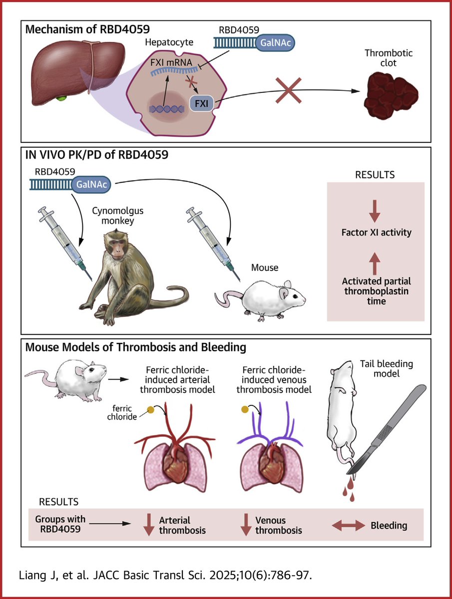 Coagulation factor XI is a promising target for safer anticoagulants. In a series of preclinical studies, novel factor XI-targeting GalNAc-siRNA RBD4059 showed high potency &amp; long-lasting antithrombotic effects w/out ⬆️ 🩸 risk. jacc.org/doi/10.1016/j.…

#JACCBTS #CardioX #cvCoag