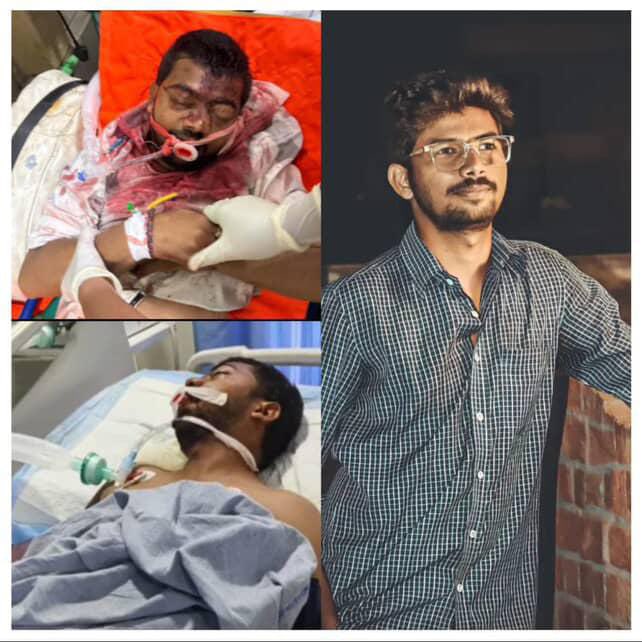 URGENT – Need Help 🙏

Sanjay Kumar Koduri is undergoing treatment at Sree Lakshmi Neuro &amp; Trauma Hospital, Karimnagar after a severe accident. The family has pooled in all they could, but Rs. 5 Lakh more is needed for his medical expenses.
Please consider supporting. Every rupee