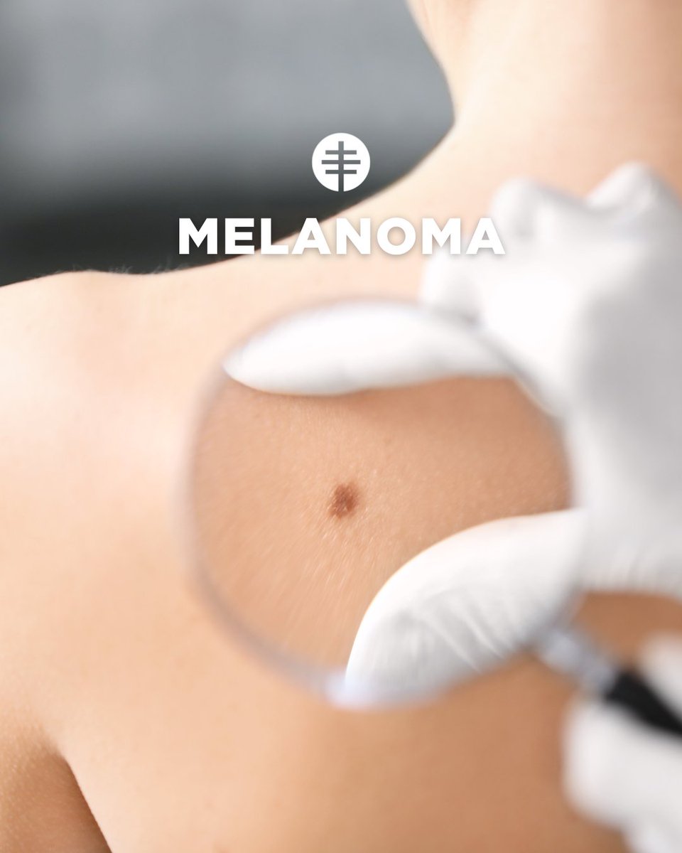 This #SkinCancerAwarenessMonth, let's shed light on the importance of sun safety and regular skin checks.

☀️Always wear sunscreen when outdoors.
🔍Check yourself up and keep an eye out for any changes in moles, freckles, or new spots.
🧠Know the signs and symptoms of melanoma.