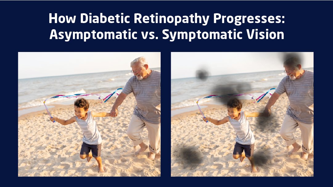 Diabetic retinopathy is still the leading cause of vision loss in working-age adults—despite available screening and treatment. Aurora AEYE brings screening to the point of care. See if it’s right for you:
hubs.li/Q03wgN9Y0
#AuroraAEYE #OptomedUS #AEYEHealth