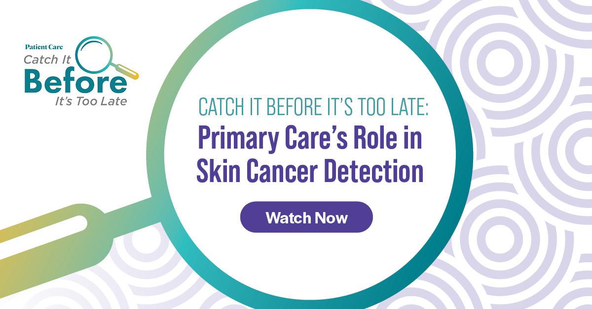 Optimize your skin cancer screening workflow. This series details how visual examination, clinical judgment, and patient-reported changes are integral to evaluating suspicious lesions, alongside the evolving role of AI tools. Learn more: hubs.li/Q03w6D-H0