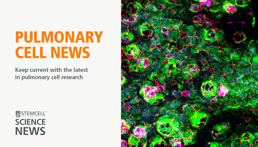 Interested in #COPD, #PulmonaryFibrosis, or #LungCancer research? 🫁 

Pulmonary Cell News delivers the latest updates on pulmonary disease and cell biology. 

Don't miss out on these updates! Subscribe here: bit.ly/4kkWMEu