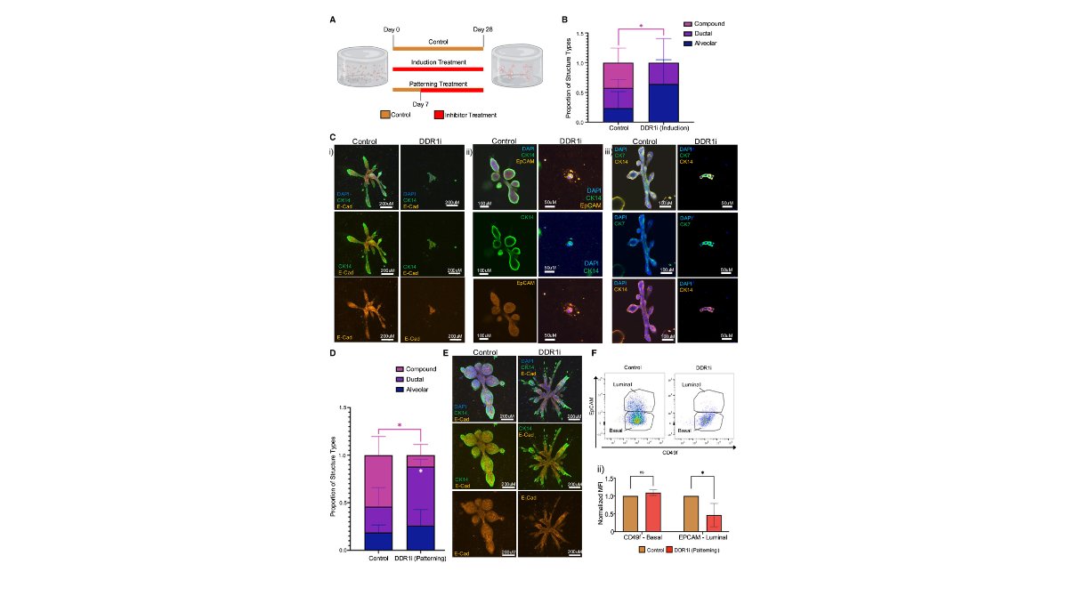 stemcellreports's tweet image. New primary breast #organoid research from @TuftsMedSchool published in Stem Cell Reports! DDR1 regulates RUNX1-CBFβ to control breast stem cell differentiation. #organogenesis #stemcells
@ISSCR @CellPressNews @GairdnerAwards @SickKidsNews
ow.ly/hxl250WlH5o