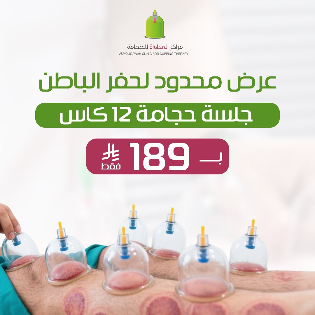 Almoudawah's tweet image. من اليوم حتى الجمعة بس!
📍 في فرع حفر الباطن – مركز المداواة
🩸 جلسة حجامة 12 كاس بـ189 ريال بدل 250
✅ تنشط دورتك الدموية
✅ تقلل الشد والإرهاق
✅ تحفز الجسم على الشفاء الذاتي
وكل هذا في أجواء طبية بإشراف متخصصين
🎯 اغتنم الفرصة وخذ خطوة لراحة جسمك
📞 للحجز والاستفسار:…