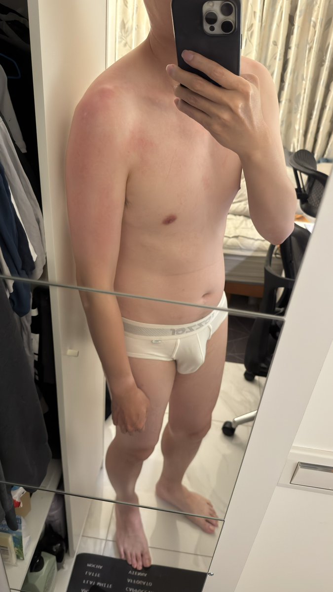 曬傷好一點點了