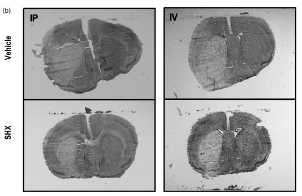NickBlondeau's tweet photo. 🚨 We identified serRS as a novel drug target with potent anti-ischemic effects, both in vitro and in vivo.
This highlights the feasibility of developing serRS inhibitors as prospective #stroke #therapeutics.
Check it out @_JCBFM 👉 https://t.co/lOqpFPhbYn
#DrugDiscovery https://t.co/NILajLY2sm