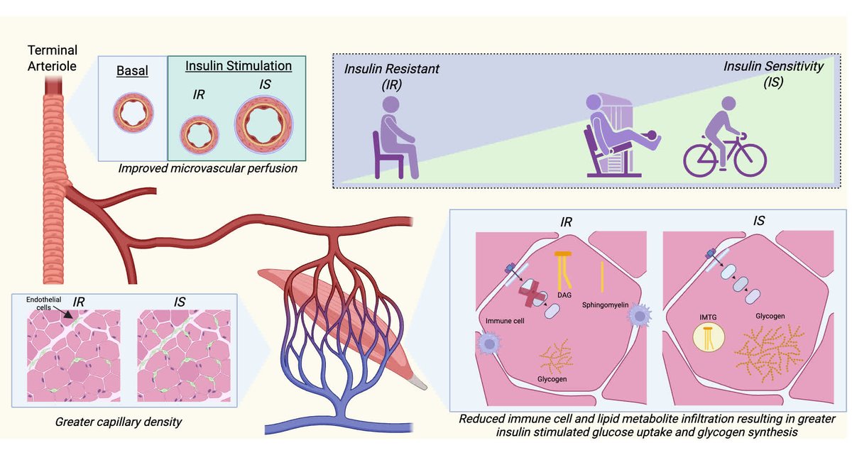 Circulation Research (@circres) on Twitter photo <a href="/CircRes/">Circulation Research</a> Compendium on #Cardiopulmonary Disease and #Exercise
Unraveling Skeletal #Muscle #Insulin Resistance: Molecular Mechanisms and the Restorative Role of Exercise ahajrnls.org/4liG5tN
Authored by <a href="/KatieWhytock/">Katie Whytock PhD</a> & BH Goodpaster <a href="/CircRes/">Circulation Research</a> Compendium on #Cardiopulmonary Disease and #Exercise
Unraveling Skeletal #Muscle #Insulin Resistance: Molecular Mechanisms and the Restorative Role of Exercise ahajrnls.org/4liG5tN
Authored by <a href="/KatieWhytock/">Katie Whytock PhD</a> & BH Goodpaster