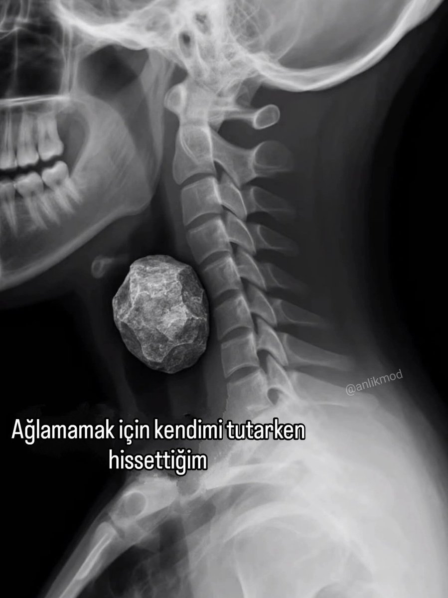 ANLIK (@anlikmod) on Twitter photo 