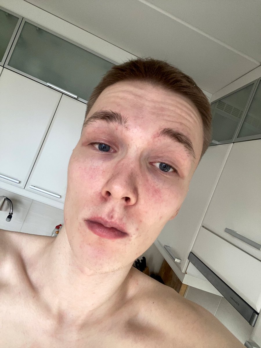 NiklasKartier's tweet photo. IM ALIVEEEEE AND SEXYYYY https://t.co/MhPHGqd1Yj