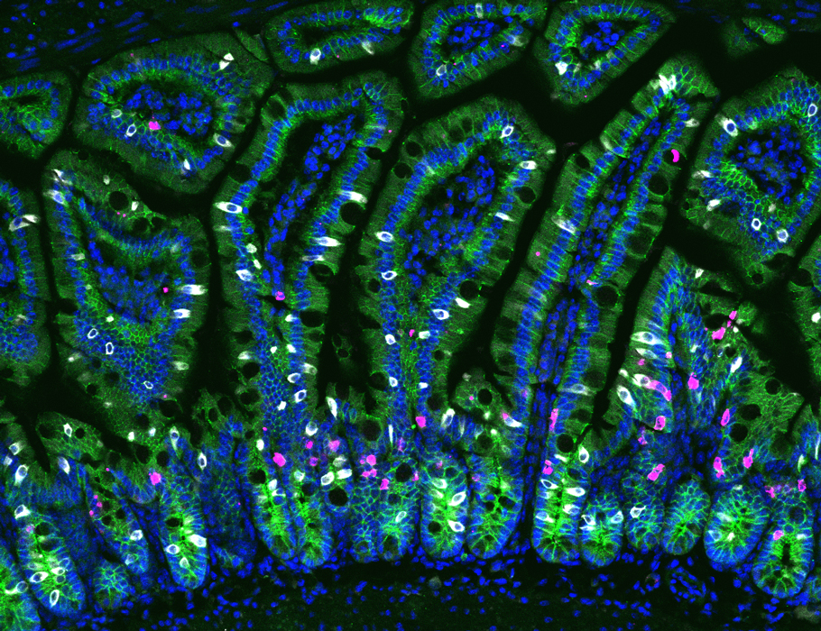 SciImmunology's tweet photo. Scientists have identified the transcription factor Spi-B to be a checkpoint that restrains excessive #TuftCell-mediated type 2 immunity and food #allergy in mice. @Westlake_Uni @Tsinghua_Uni
Learn more in Science #Immunology: https://t.co/vuRZ8fpLM7 https://t.co/gOtzVOqoM7