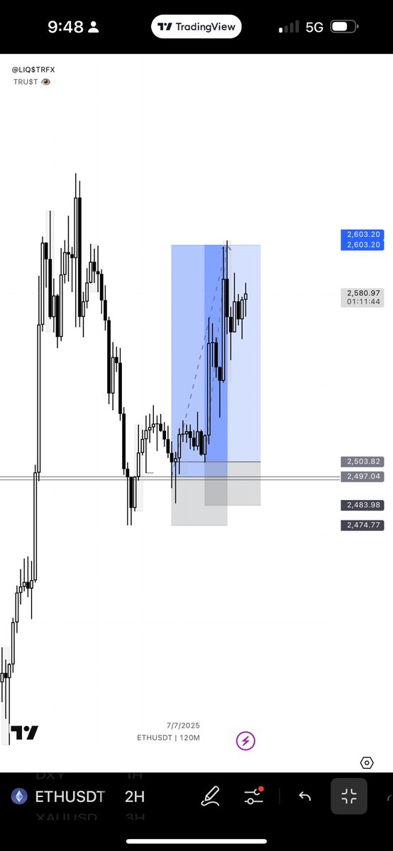 #ETH

<a href="/trader0135/">mae☆tro</a> 
<a href="/TheCRTrader/">Ezekiel 𝕏</a> 
<a href="/abdvlxTM/">𓅓.</a> 
<a href="/dBigace/">.</a>