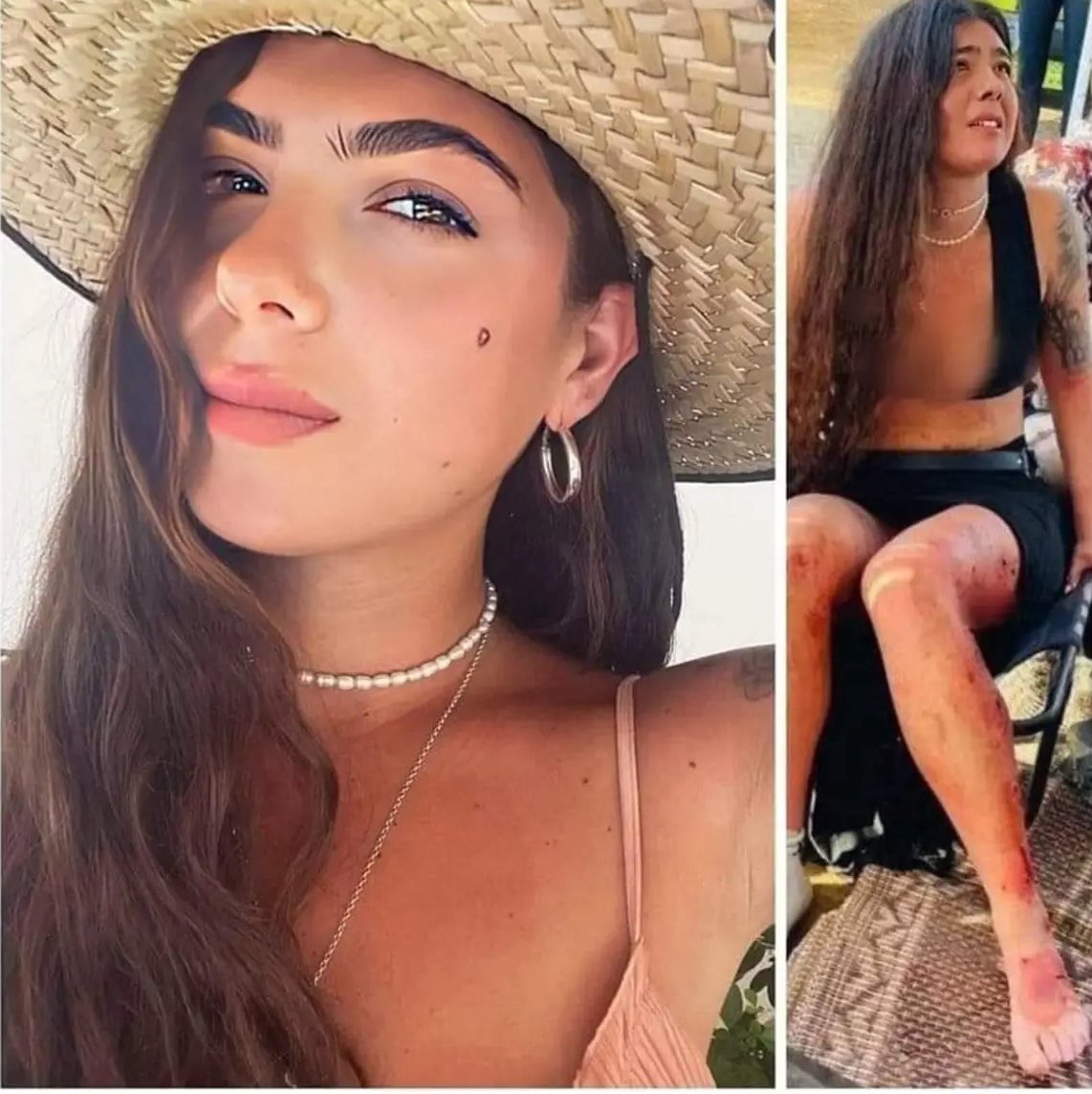 Vivid.🇮🇱 tweet media