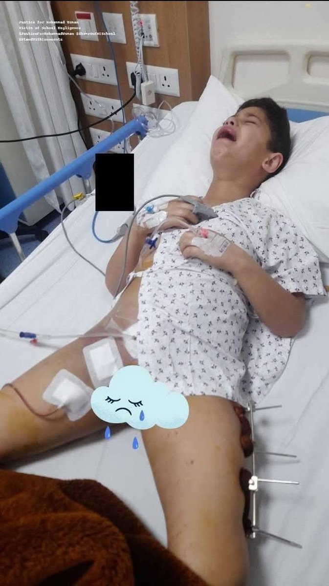 Nawakadal3's tweet image. Message to Hon'ble Education Minister Sakina Itoo Ji:
Respected Madam,
Before reopening schools and talking about class timings, please take a moment to think about the child who can no longer sit in a classroom.
💔 My 7-year-old son Mohammad Usman is lying in a hospital bed…