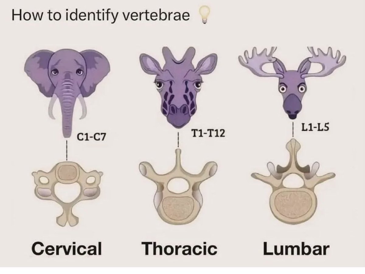 Doctors_GUILD's tweet photo. How to identify vertebrae https://t.co/6DCmN34Twy