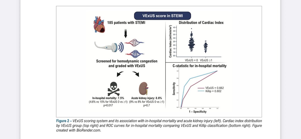 Gustavo Araujo (@dr_gusaraujo) on Twitter photo Just out in @arqbrascardio!
We applied the #VExUS score — originally for heart failure — to patients with STEMI.
🫀 A simple bedside tool with strong prognostic value!
📄 abccardiol.org/wp-content/upl…
<a href="/guilhermehtelo/">Guilherme Teló</a> <a href="/guilhermehtelo/">Guilherme Teló</a> <a href="/GEICC3/">Rodrigo V. Wainstein, MD, PhD</a> <a href="/saadi_marina/">Marina Saadi</a> Just out in @arqbrascardio!
We applied the #VExUS score — originally for heart failure — to patients with STEMI.
🫀 A simple bedside tool with strong prognostic value!
📄 abccardiol.org/wp-content/upl…
<a href="/guilhermehtelo/">Guilherme Teló</a> <a href="/guilhermehtelo/">Guilherme Teló</a> <a href="/GEICC3/">Rodrigo V. Wainstein, MD, PhD</a> <a href="/saadi_marina/">Marina Saadi</a>