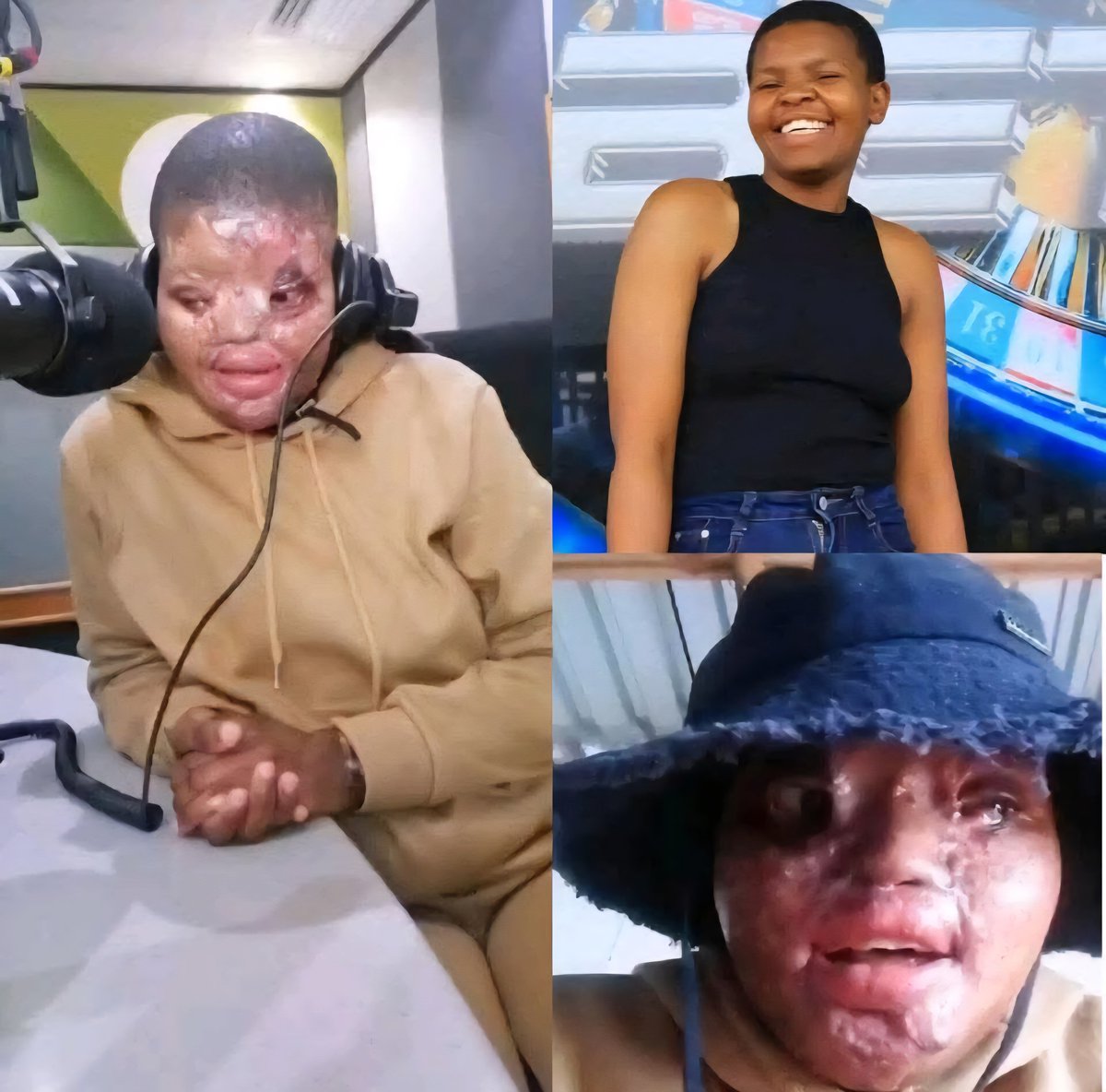 Limpopo Chronicle (@limchronicle) on Twitter photo ๐๐๐ ๐ฃ๐ข๐ฃ๐ข ๐ฃ๐ข๐๐๐๐ ๐ฃ๐ฅ๐ข๐๐ ๐๐๐๐ ๐๐ง๐ง๐๐๐ ๐๐๐ฆ๐
Police in Limpopo are probing a disturbing case of attempted murder that occurred at Mogoto village, Zebediela, following an incident that was initially reported as assault, with grievous bodily harm.
The ๐๐๐ ๐ฃ๐ข๐ฃ๐ข ๐ฃ๐ข๐๐๐๐ ๐ฃ๐ฅ๐ข๐๐ ๐๐๐๐ ๐๐ง๐ง๐๐๐ ๐๐๐ฆ๐
Police in Limpopo are probing a disturbing case of attempted murder that occurred at Mogoto village, Zebediela, following an incident that was initially reported as assault, with grievous bodily harm.
The