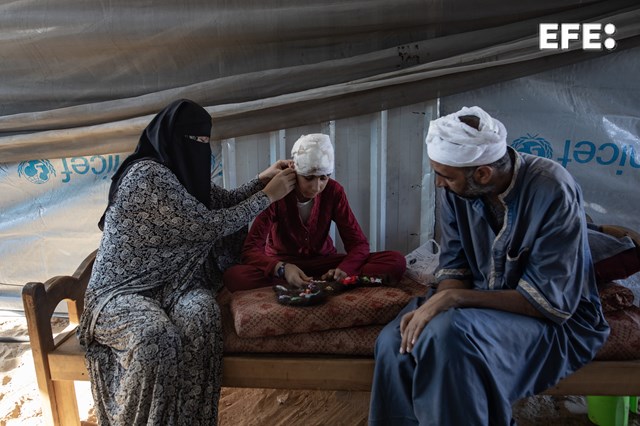 #EFEPHOTOS | 12-year-old Hala was playing near her tent in Gaza when a strike hit nearby. The swing collapsed, tearing off her scalp. She needs urgent care, but border closures are blocking her evacuation. 

📸Haitham Imad
#Gaza #HalaAbuDahlez #Palestine #Israel