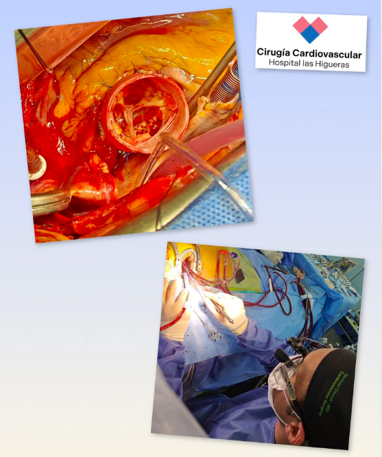 Germán Chaud tweet media