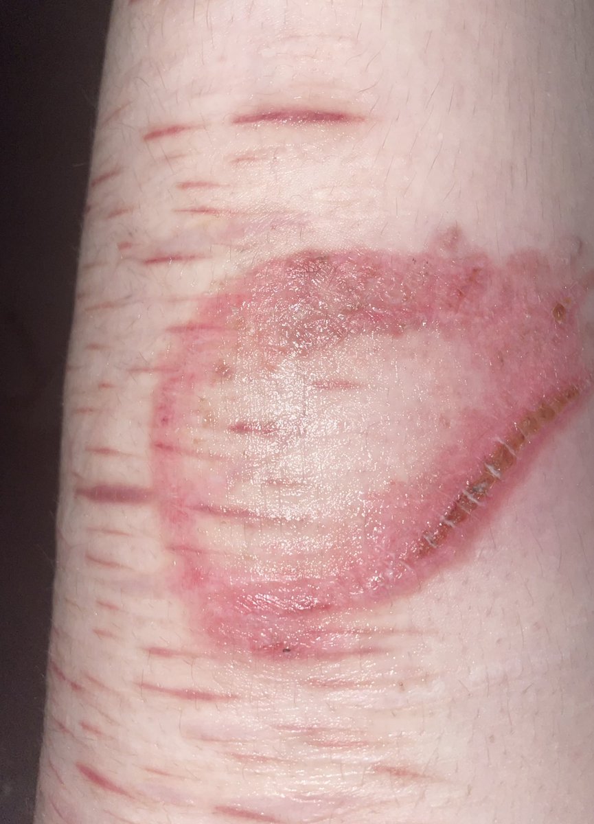 after putting moisturizer on this i feel very professional